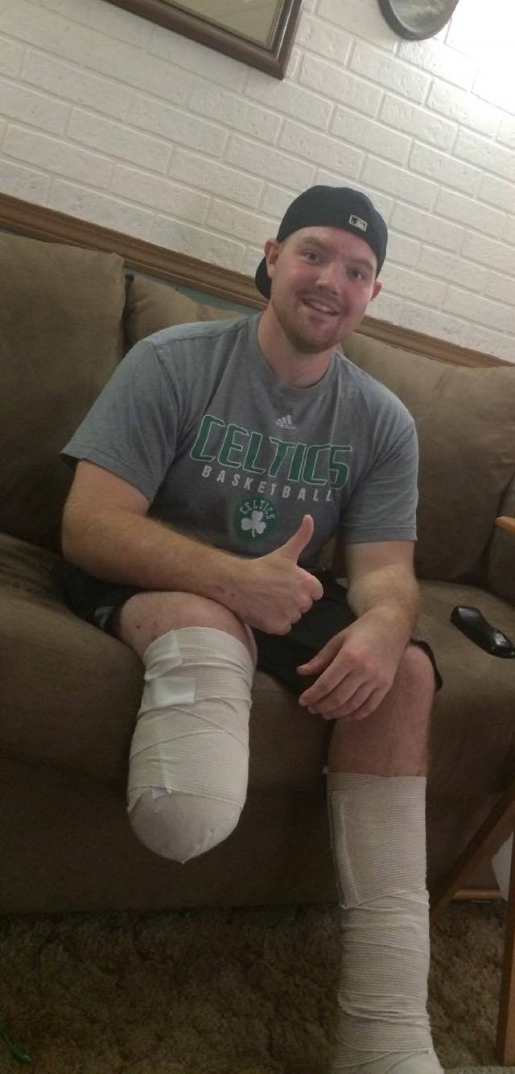 Castleton alum recovering after serious accident